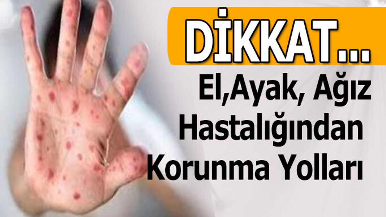 El, Ayak, Ağız Hastalığından Korunma Yolları
