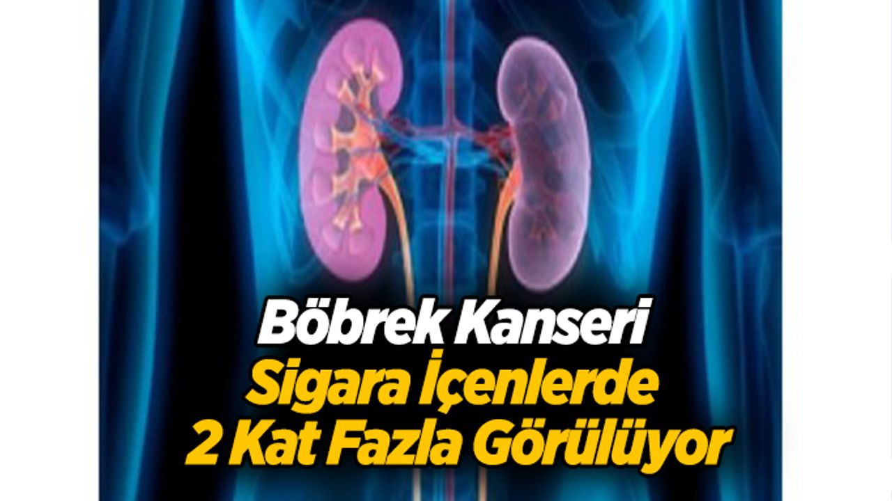 Böbrek Kanseri Sigara İçenlerde 2 Kat Fazla Görülüyor