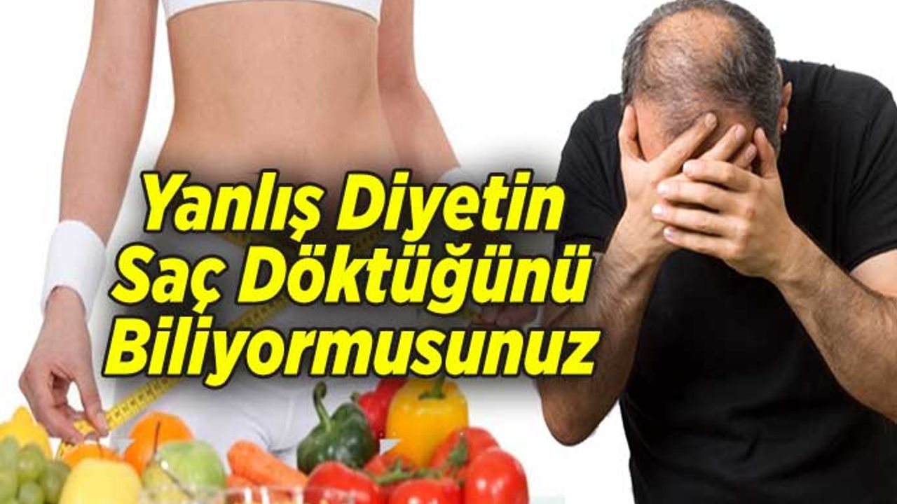 Yanlış Diyetin Saç Döktüğünü Biliyormusunuz