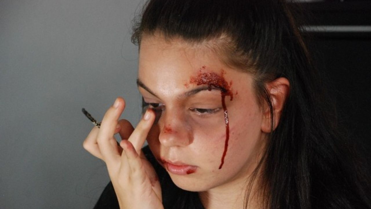 Onu gören, çığlık atıp, ambulansı arıyor