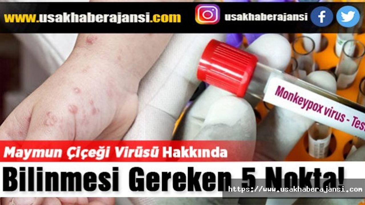 Maymun Çiçeği Virüsü Hakkında Bilinmesi Gereken 5 Nokta!