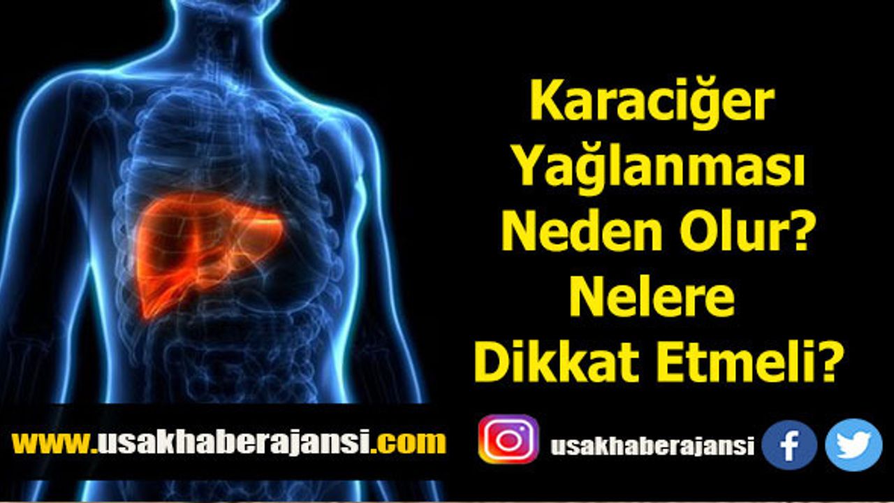 Karaciğer Yağlanması Neden Olur? Nelere Dikkat Etmeli?