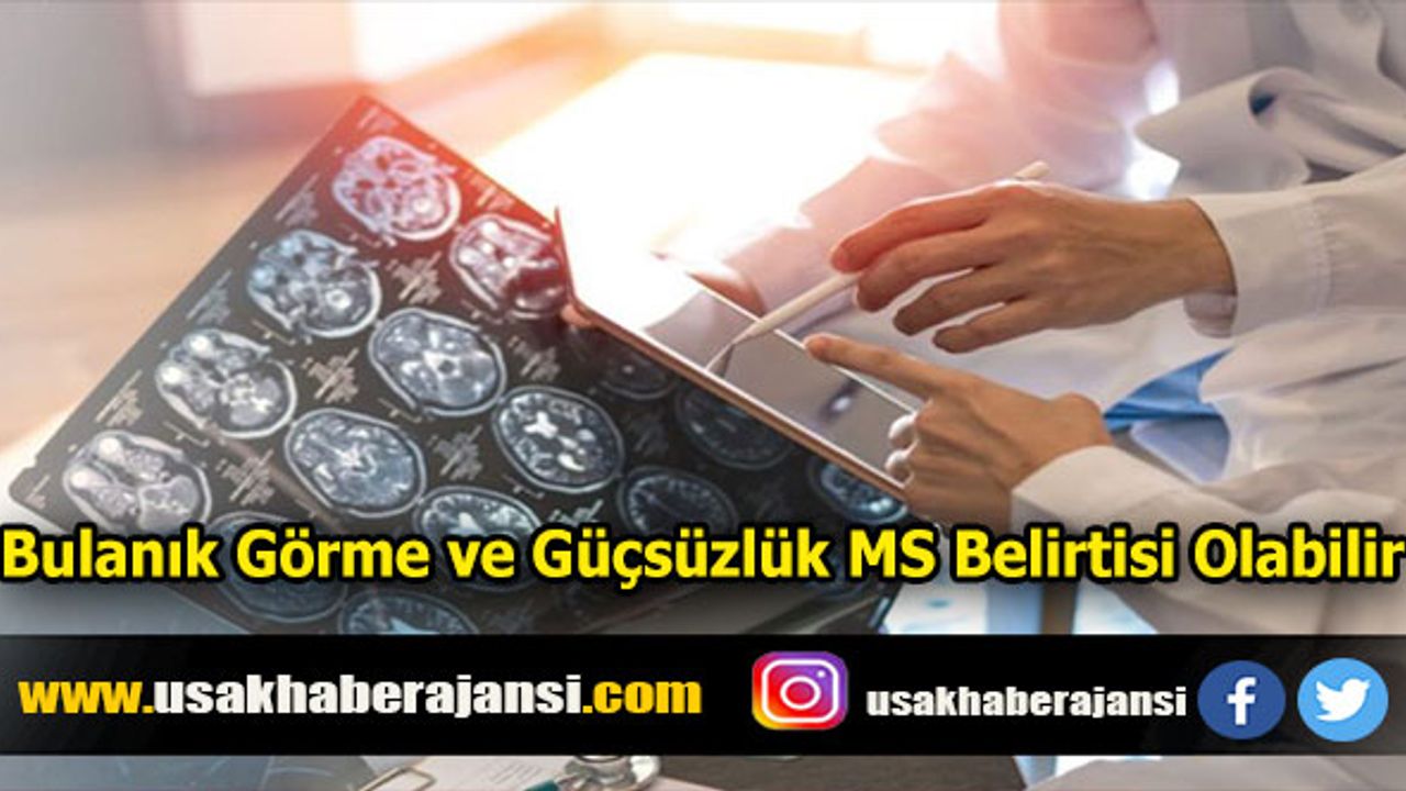 Bulanık Görme ve Güçsüzlük MS Belirtisi Olabilir
