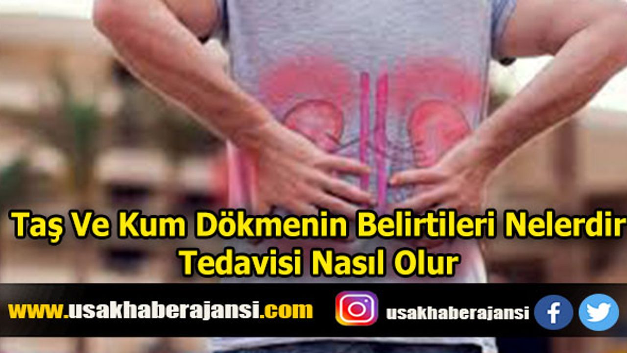 Taş Ve Kum Dökmenin Belirtileri Nelerdir? Tedavisi Nasıl Olur?