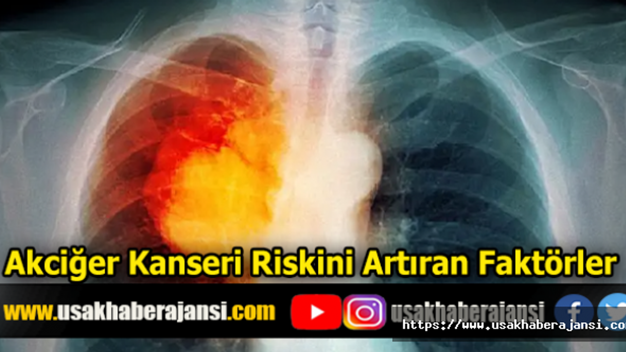 Akciğer Kanseri Riskini Artıran Faktörler