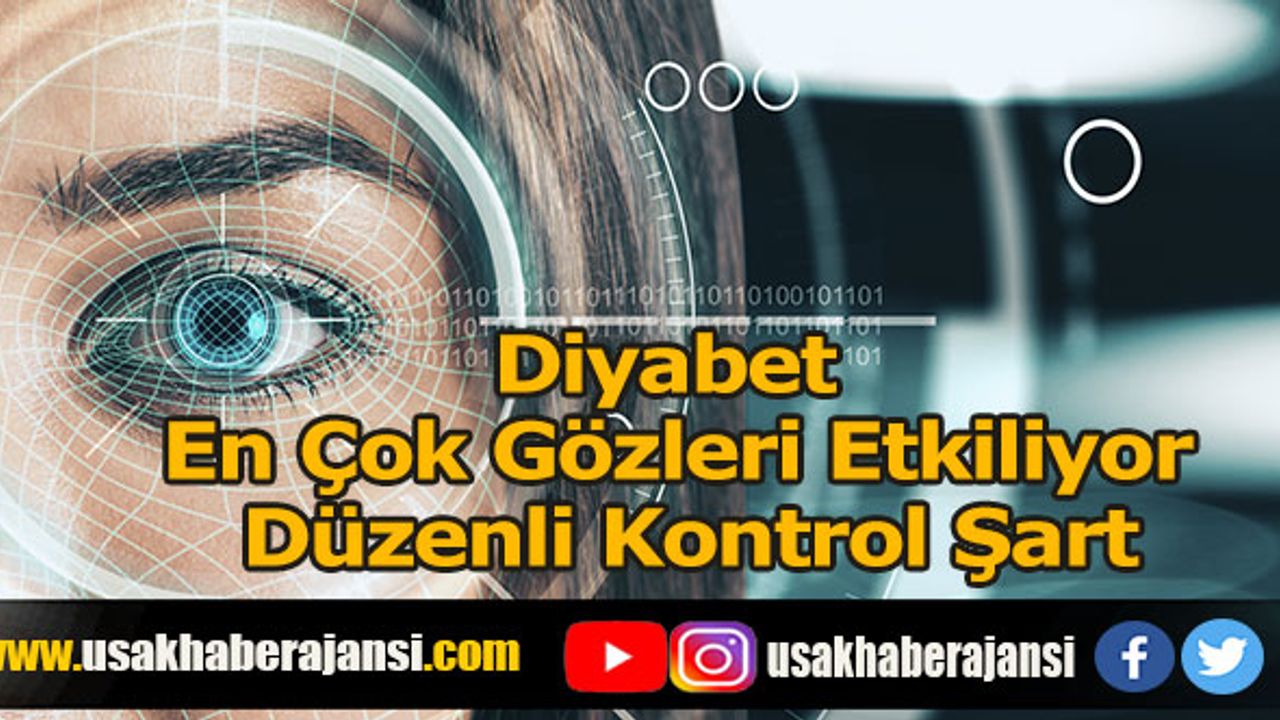 Diyabet En Çok Gözleri Etkiliyor, Düzenli Kontrol Şart