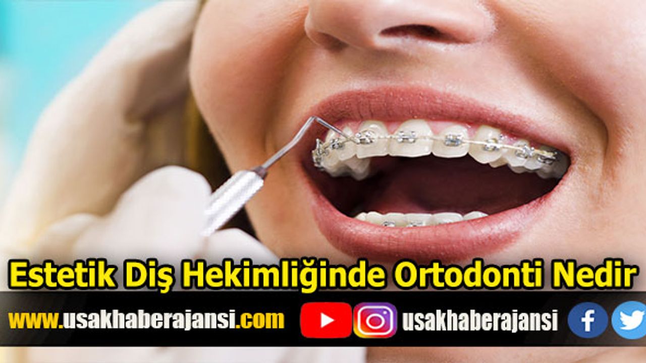 Estetik Diş Hekimliğinde Ortodonti Nedir?