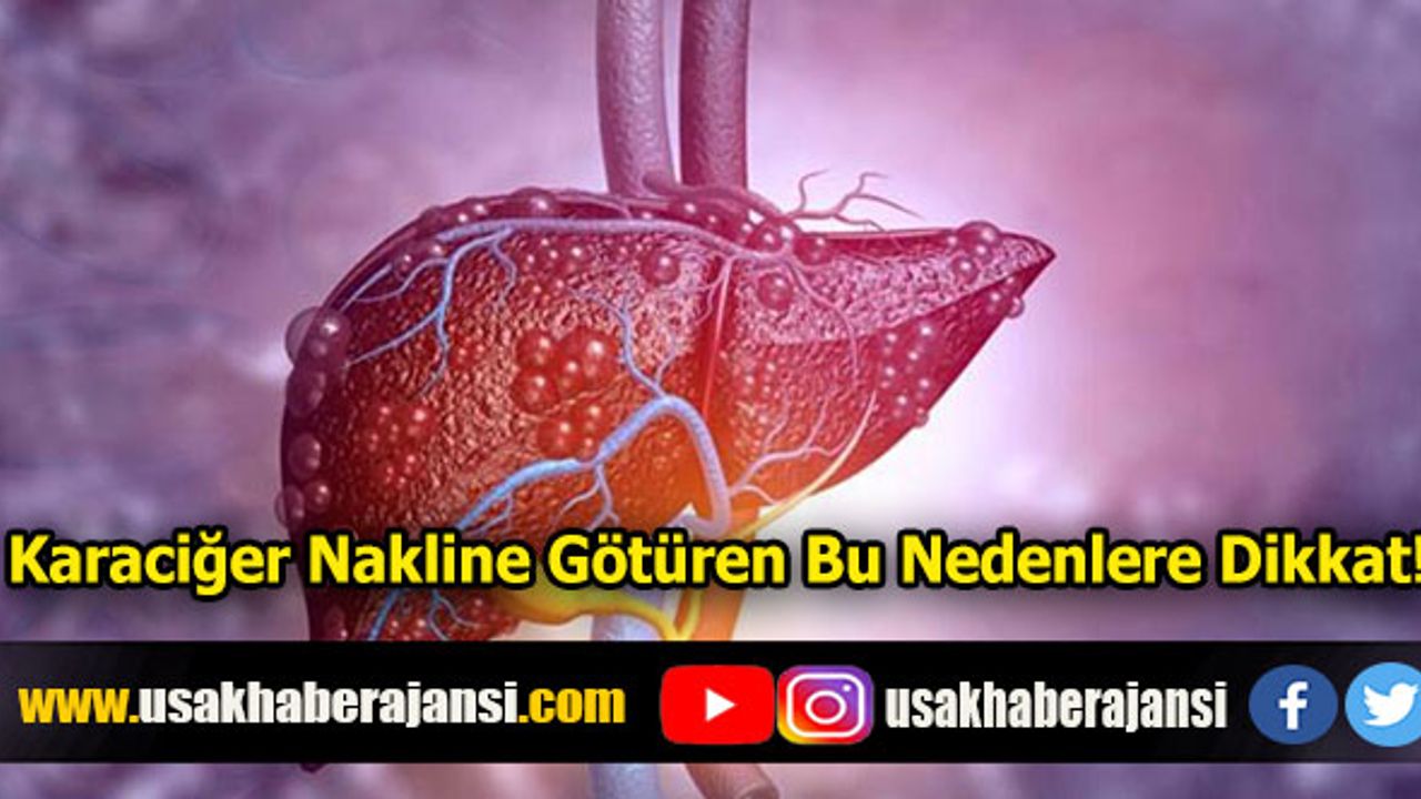 Karaciğer Nakline Götüren Bu Nedenlere Dikkat!