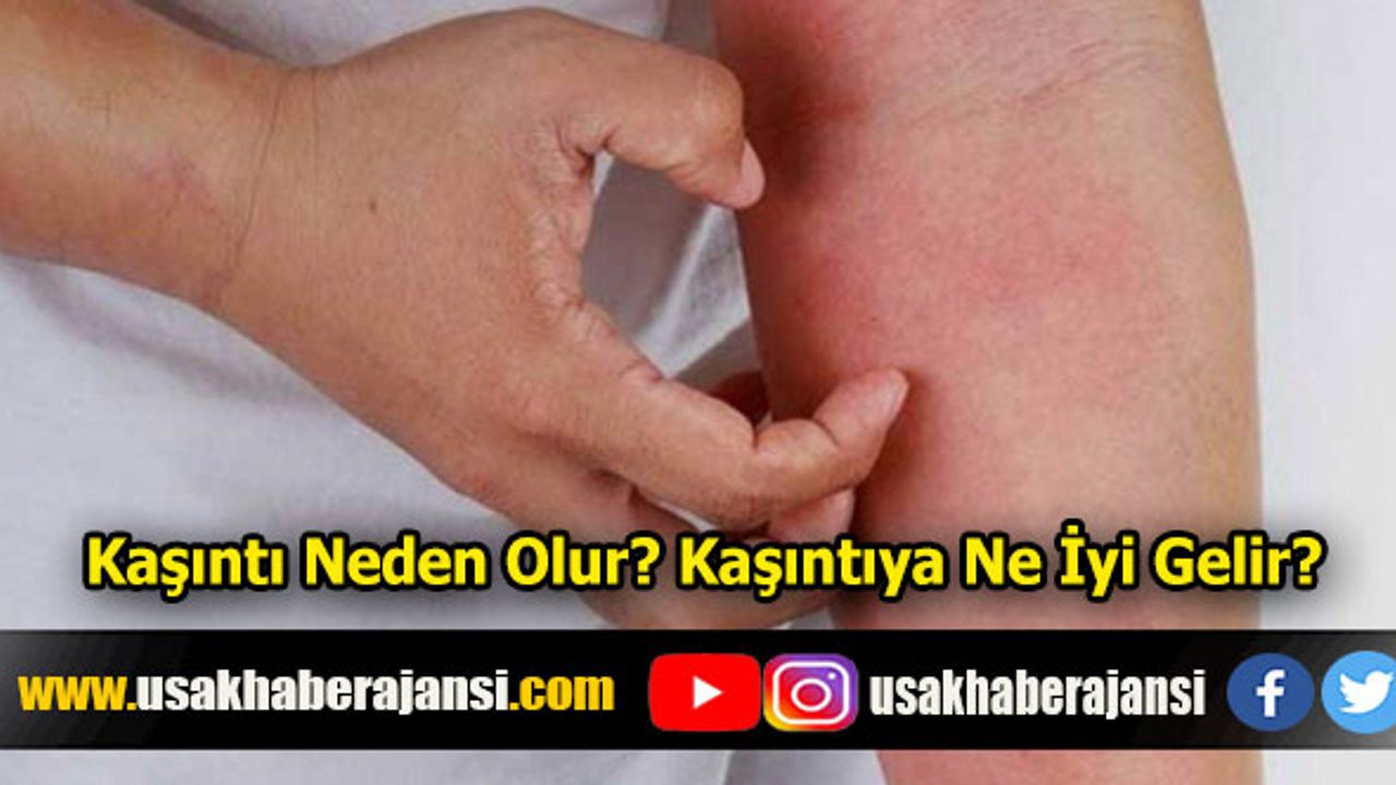 Kaşıntı Neden Olur? Kaşıntıya Ne İyi Gelir?