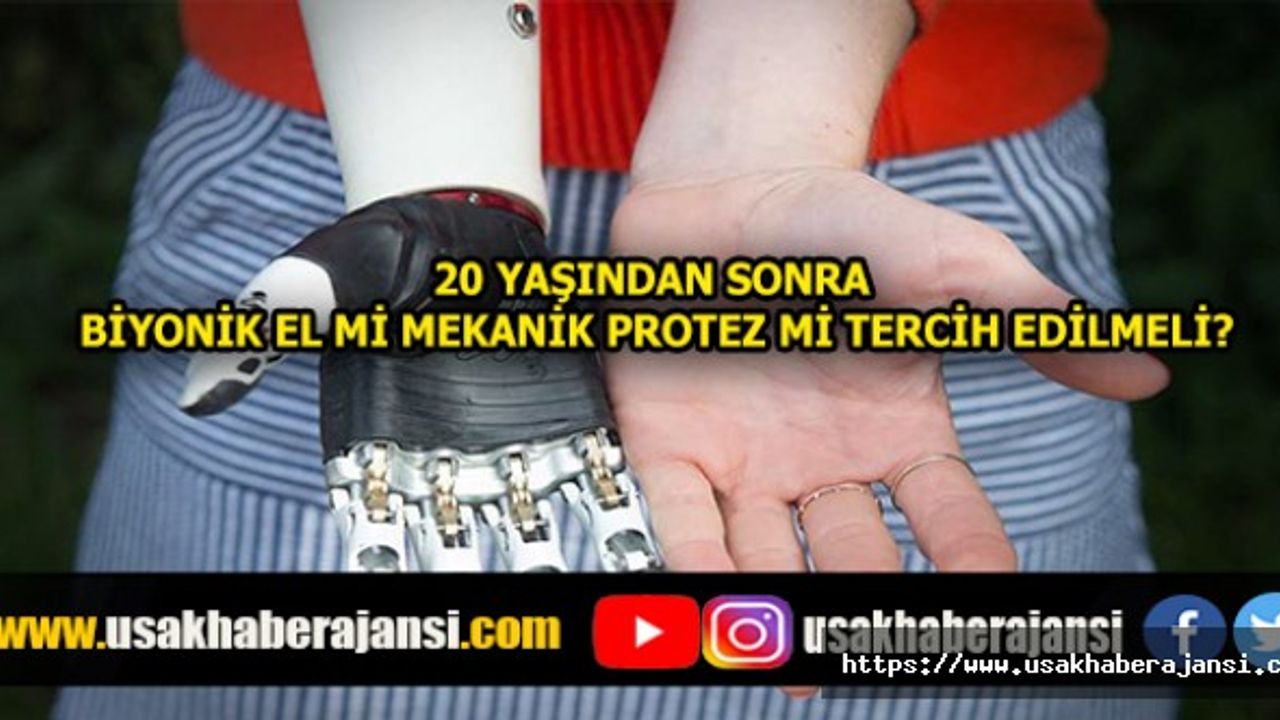 20 Yaşından Sonra Biyonik El Mi Mekanik Protez Mi Tercih Edilmeli?