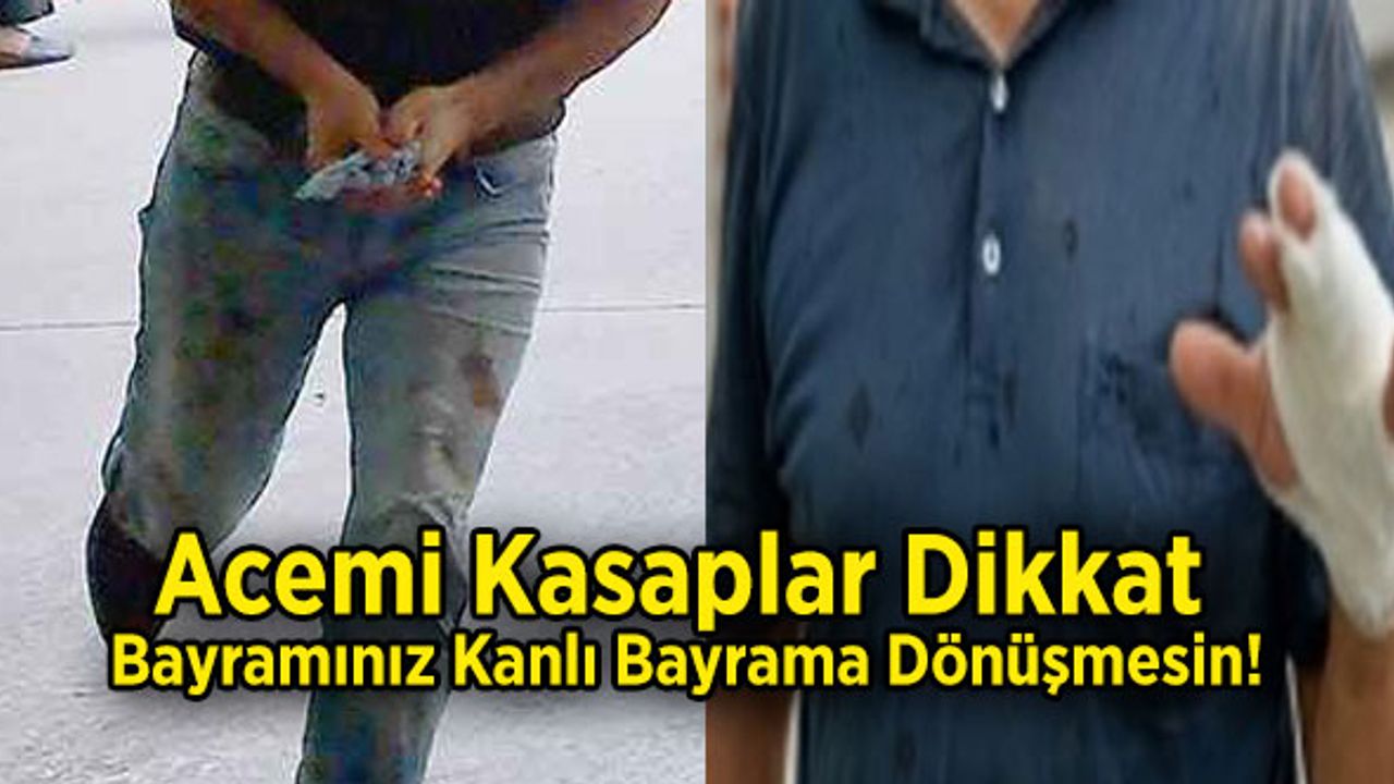 Acemi Kasaplar Dikkat, Bayramınız Kanlı Bayrama Dönüşmesin!