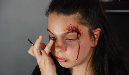 Onu gören, çığlık atıp, ambulansı arıyor
