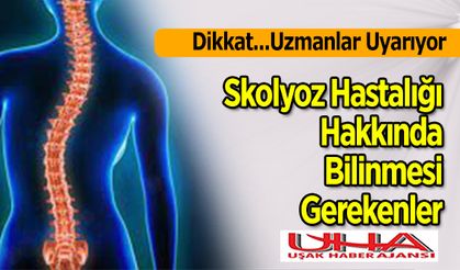 Skolyoz Hastalığı Hakkında Bilinmesi Gerekenler