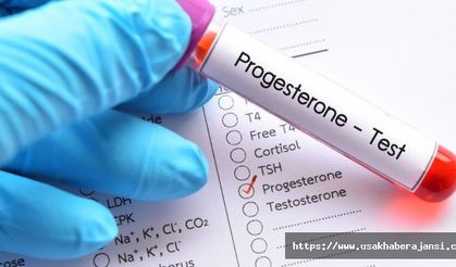 Progesteron Testi Nasıl Yapılır?