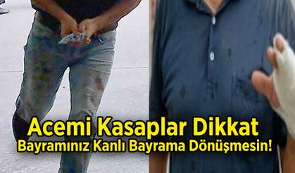 Acemi Kasaplar Dikkat, Bayramınız Kanlı Bayrama Dönüşmesin!