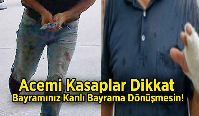 Acemi Kasaplar Dikkat, Bayramınız Kanlı Bayrama Dönüşmesin!