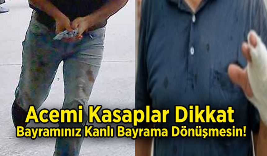 Acemi Kasaplar Dikkat, Bayramınız Kanlı Bayrama Dönüşmesin!